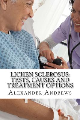 Lichen Sclerosus: Tests, Causes and Treatment Options - Doug Green Md