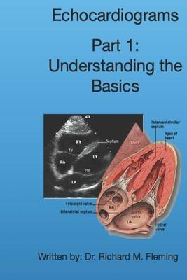 Echocardiograms - Part 1: Understanding the Basics. - Richard M. Fleming