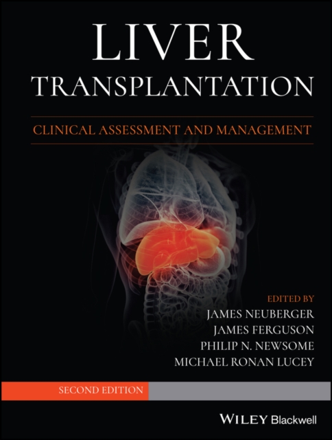 Liver Transplantation - James Neuberger