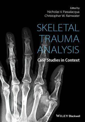 Skeletal Trauma Analysis - Passalacqua