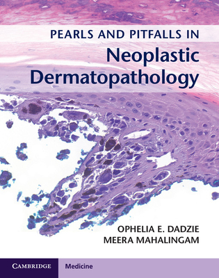 Pearls and Pitfalls in Neoplastic Dermatopathology with Online Access - Ophelia E. Dadzie