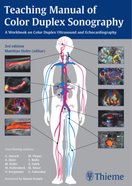 Teaching Manual of Color Duplex Sonography - Matthias Hofer
