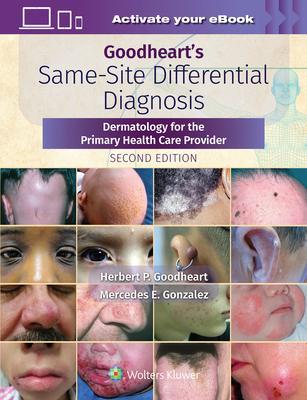 Goodheart's Same-Site Differential Diagnosis: Dermatology for the Primary Health Care Provider - Herbert Goodheart