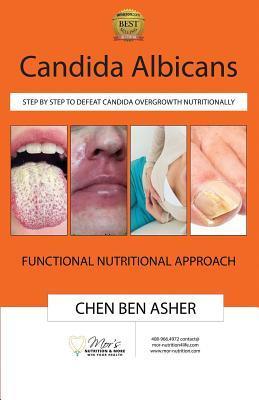 Candida Albicans: Step by Step to Defeat Candida Overgrowth Nutritionally - Chen Ben Asher