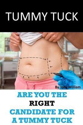 Tummy Tuck: Are You The Right Candidate For A Tummy Tuck - Tony William