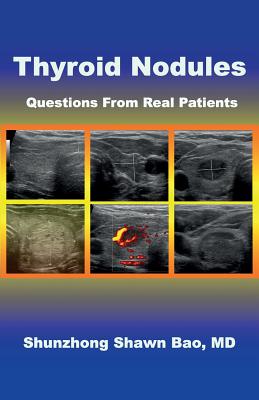 Coperta cărții 'Thyroid Nodules: Questions From Real Patients - Barbara Winter'