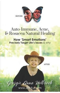 Coperta cărții 'Auto-Immune, Acne, & Rosacea Natural Healing - How 'Smart Emotions' Precisely Target Life's Issues & Why - Georgie Anna'