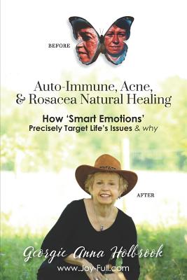 Coperta cărții 'Auto-Immune, Acne, & Rosacea Natural Healing - How 'Smart Emotions' Precisely Target Life's Issues & Why - Georgie Anna'
