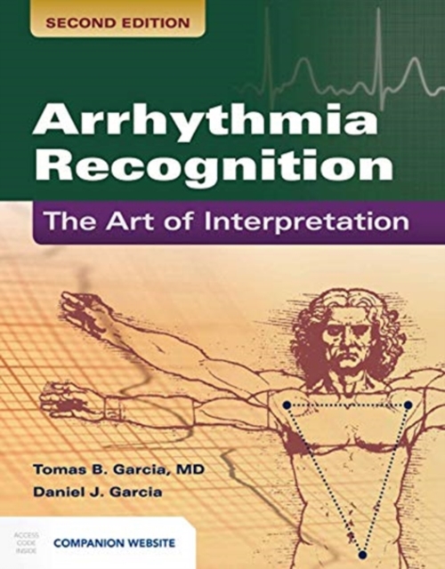 Arrhythmia Recognition: The Art of Interpretation: The Art of Interpretation - Tomas B. Garcia