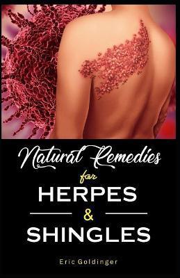 Natural Remedies For HERPES & SHINGLES: The Complete Guide - Eric Goldinger