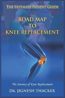 Road Map to Knee Replacement: The Journey Of Knee Replacement, Ultimate Patient Guide - Jignesh Thacker