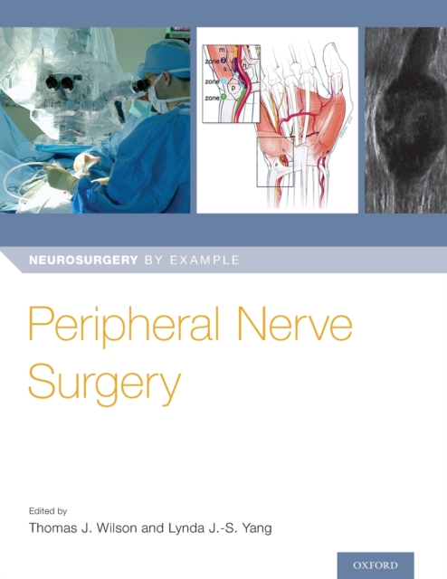 Peripheral Nerve Surgery - Thomas Wilson