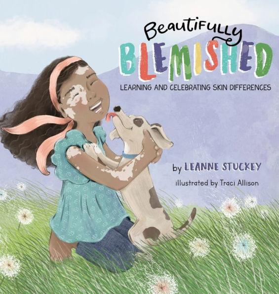 Beautifully Blemished: Learning and Celebrating Skin Differences - Leanne Stuckey