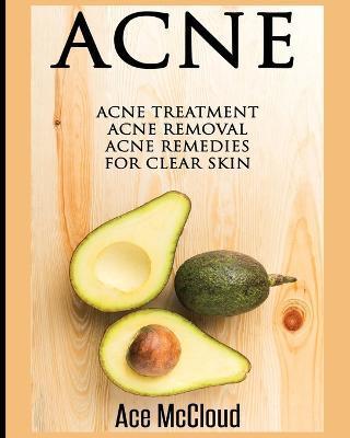 Acne: Acne Treatment: Acne Removal: Acne Remedies For Clear Skin - Ace Mccloud