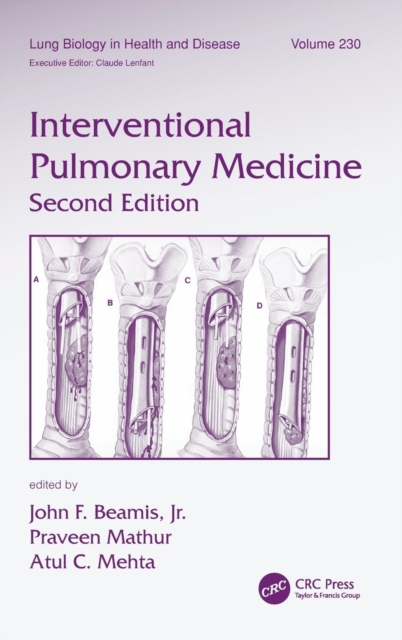 Interventional Pulmonary Medicine - John F. Beamis