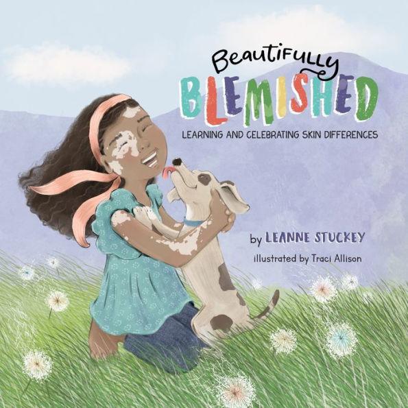 Beautifully Blemished: Learning and Celebrating Skin Differences - Leanne Stuckey