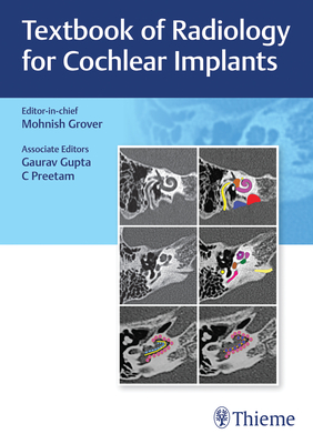 Textbook of Radiology for Cochlear Implants - Mohnish Grover