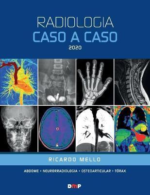 Radiologia Caso a Caso 2020 - Ricardo Mello