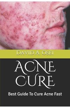 Coperta cărții 'Acne Cure: Best Guide To Cure Acne Fast - David A. Osei'