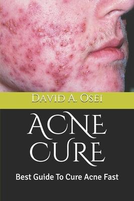 Acne Cure: Best Guide To Cure Acne Fast - David A. Osei