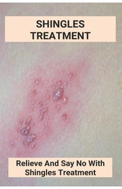 Coperta cărții 'Shingles Treatment: Relieve And Say No With Shingles Treatment: Shingles On Face Treatment - Columbus Tomasic'