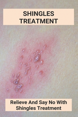 Coperta cărții 'Shingles Treatment: Relieve And Say No With Shingles Treatment: Shingles On Face Treatment - Columbus Tomasic'