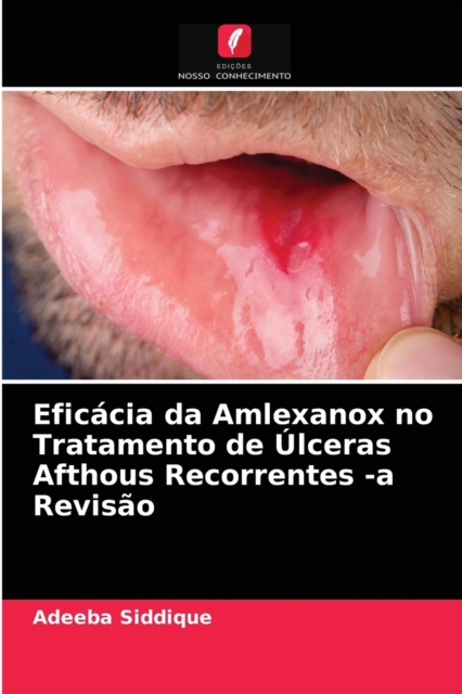 Eficácia da Amlexanox no Tratamento de Úlceras Afthous Recorrentes -a Revisão - Adeeba Siddique