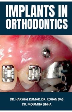 Poza produsului Implants in Orthodontics - Harshal