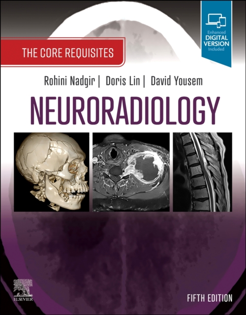 Neuroradiology: The Core Requisites - Rohini Nadgir