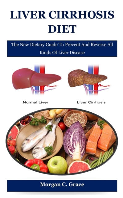 Liver Cirrhosis Diet: The New Dietary Guide To Prevent And Reverse All Kinds Of Liver Disease - Morgan C. Grace