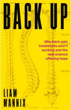 Coperta cărții 'Back Up: Why back pain treatments aren't working and the new science offering hope - Liam Mannix'