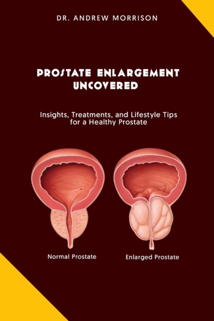 Prostrate Enlargement Uncovered: Insights, Treatments, and Lifestyle Tips for a Healthy Prostate - Andrew Morrison