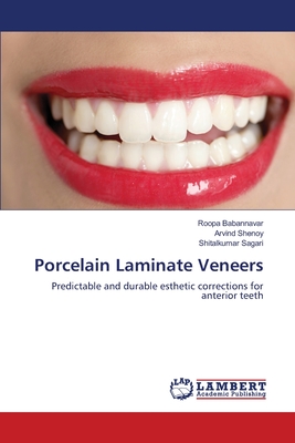 Porcelain Laminate Veneers - Roopa Babannavar