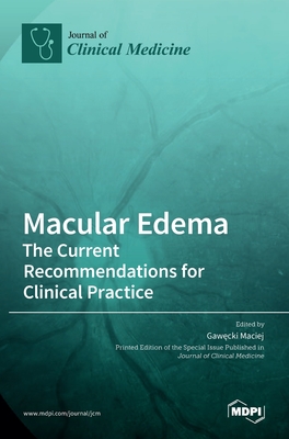 Macular Edema: The Current Recommendations for Clinical Practice - Gawecki Maciej