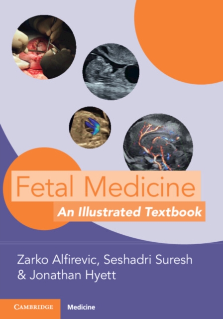 Fetal Medicine: An Illustrated Textbook - Zarko Alfirevic