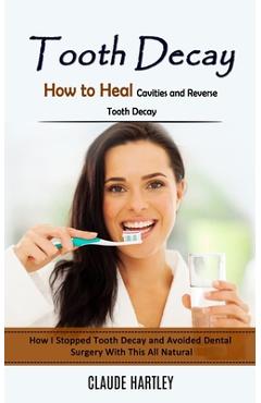 Coperta cărții 'Tooth Decay: How to Heal Cavities and Reverse Tooth Decay (How I Stopped Tooth Decay and Avoided Dental Surgery With'