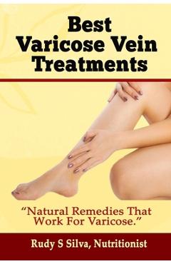 Coperta cărții 'Best Varicose Vein Treatments: Natural Remedies That Work for Varicose - Rudy Silva Silva'