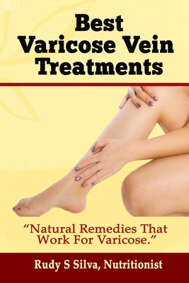 Best Varicose Vein Treatments: Natural Remedies That Work for Varicose - Rudy Silva Silva