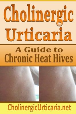 Cholinergic Urticaria: A Guide to Chronic Heat Hives - B. Page