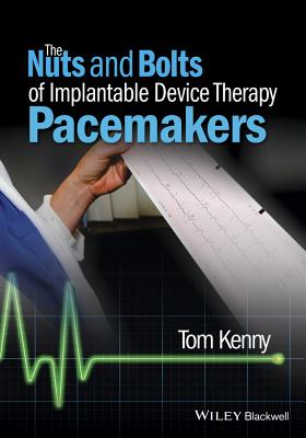 The Nuts and Bolts of Implantable Device Therapy: Pacemakers - Tom Kenny
