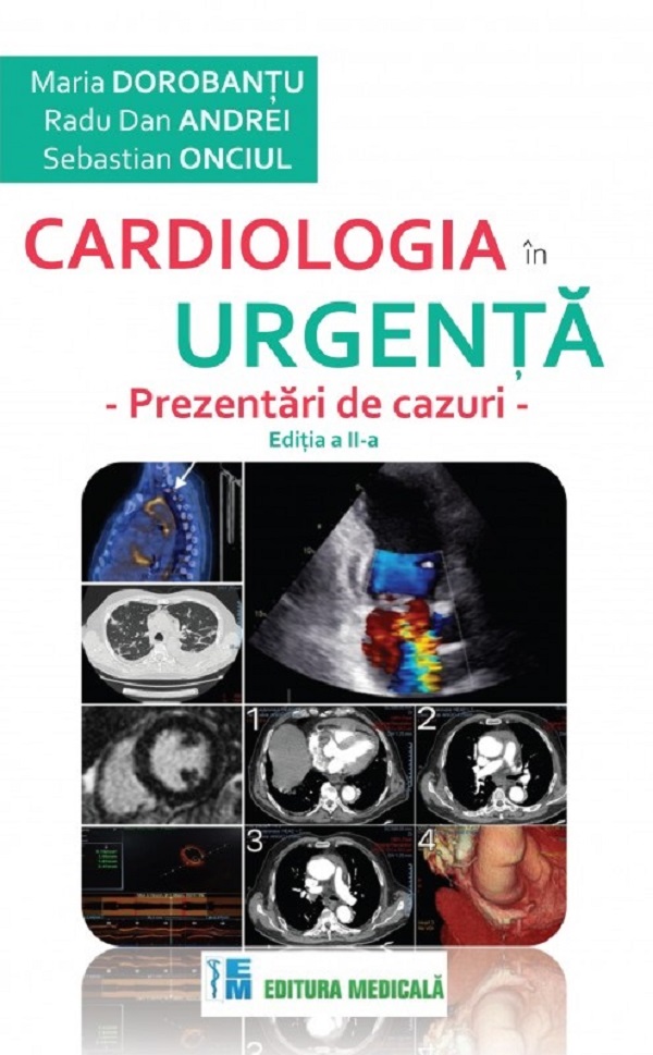Cardiologia in urgenta. Prezentari de cazuri - Maria Dorobantu, Radu Dan Andrei, Sebastian Onciul