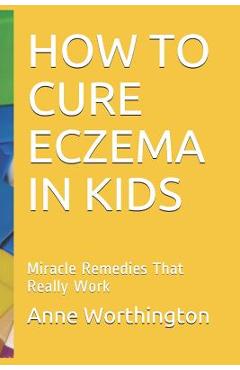 Coperta cărții 'How to Cure Eczema in Kids: Miracle Remedies That Really Work - Anne Worthington'