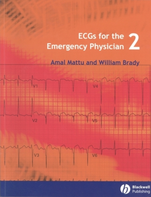 Ecgs for the Emergency Physician 2 - Amal Mattu