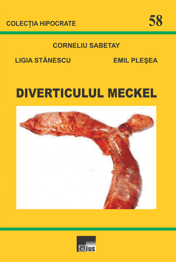 Diverticulul Meckel - Corneliu Sabetay, Ligia Stanescu, Emil Plesea