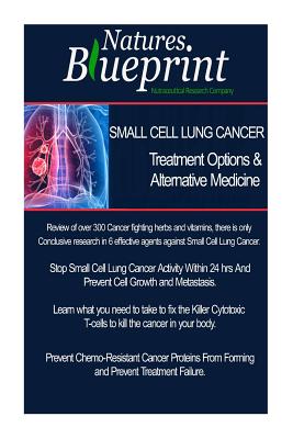 Coperta cărții 'Small Cell Lung Cancer - Treatment Options and Alternative Medicine - Christian Vazquez'