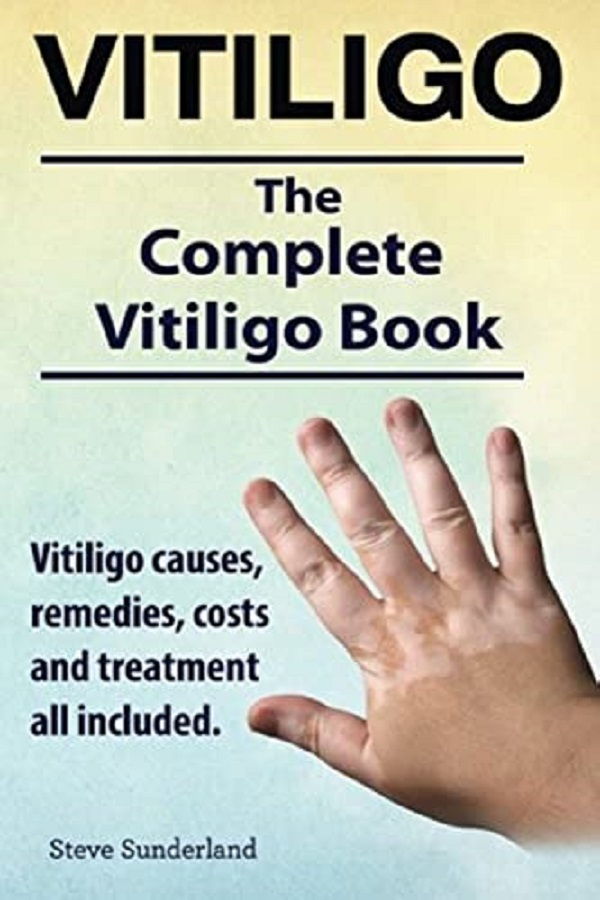 Vitiligo - Steve Sunderland
