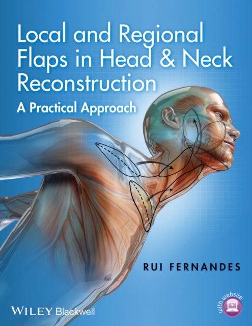 Local and Regional Flaps in Head and Neck Reconstruction: A Practical Approach - Rui Fernandes