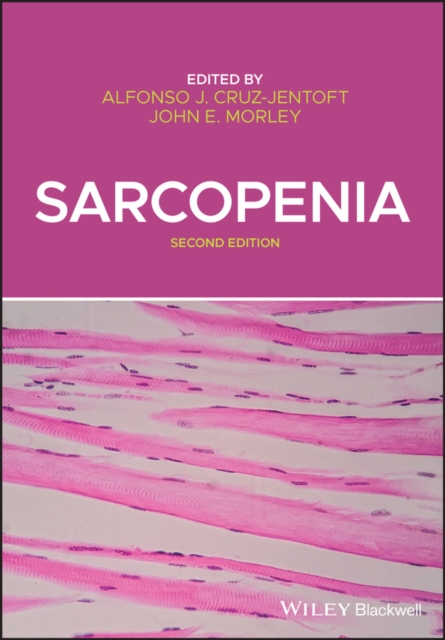 Sarcopenia - Alfonso J. Cruz-jentoft