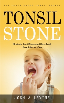 Tonsil Stones: The Truth about Tonsil Stones (Eliminate Tonsil Stones and Have Fresh Breath in Just Days!) - Joshua Levine