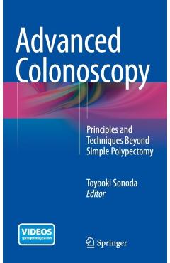 Poza produsului Advanced Colonoscopy: Principles and Techniques Beyond Simple Polypectomy - Toyooki Sonoda
